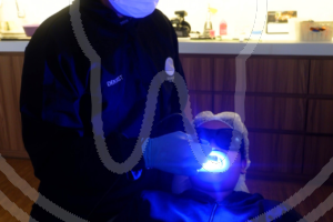 Laser dental treatment at kanou dental